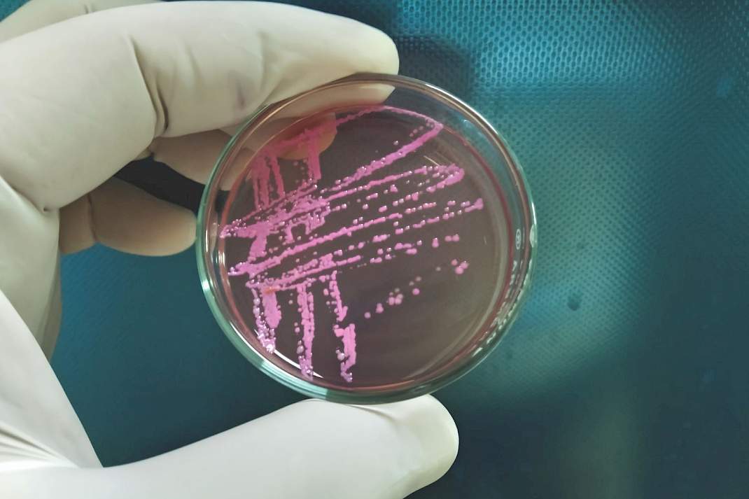 Als men het kweekmedium MacConkey agar gebruikt en hier liggen allemaal roze stipjes op, dan weet iedereen: roze stipjes, dat is E. coli.